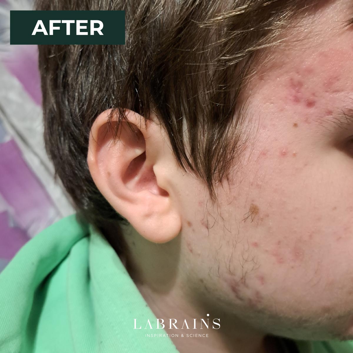 LaBrains Pore Perfect Serum - Huid Visie