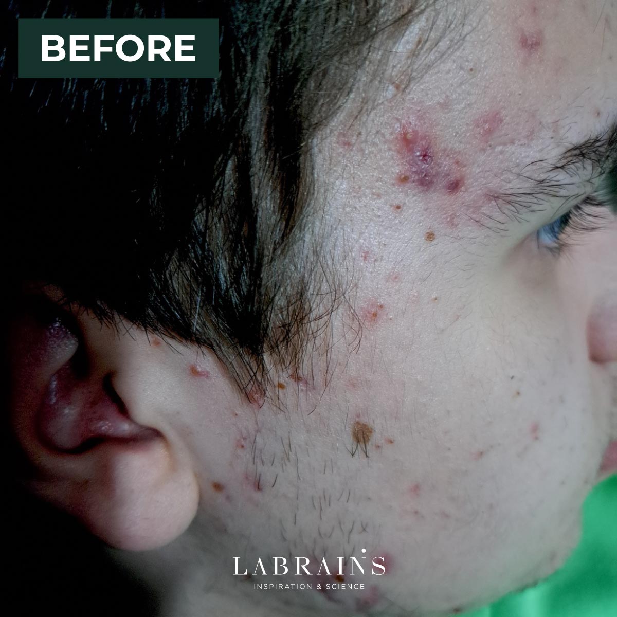 LaBrains Pore Perfect Serum - Huid Visie