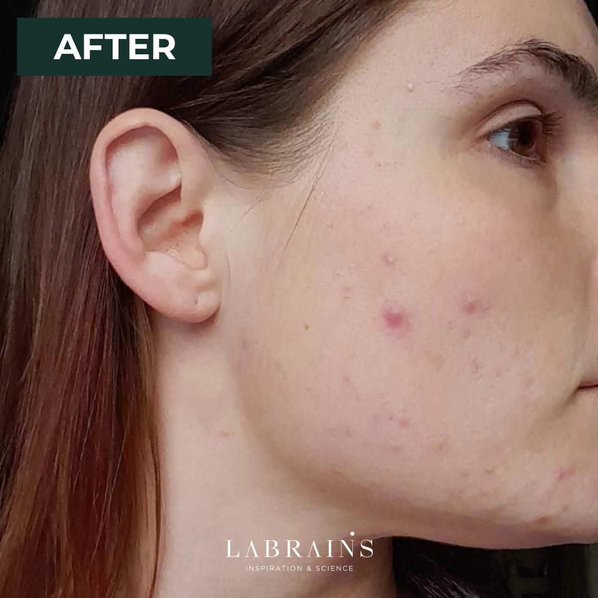 LaBrains Pore Perfect Serum - Huid Visie