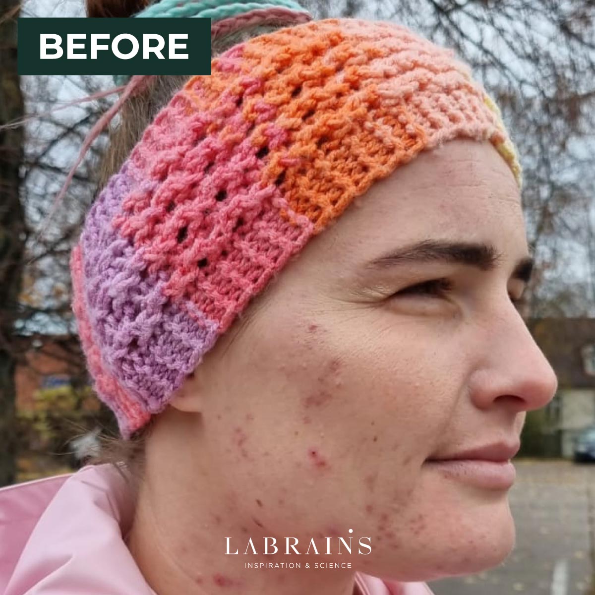 LaBrains Pore Perfect Serum - Huid Visie